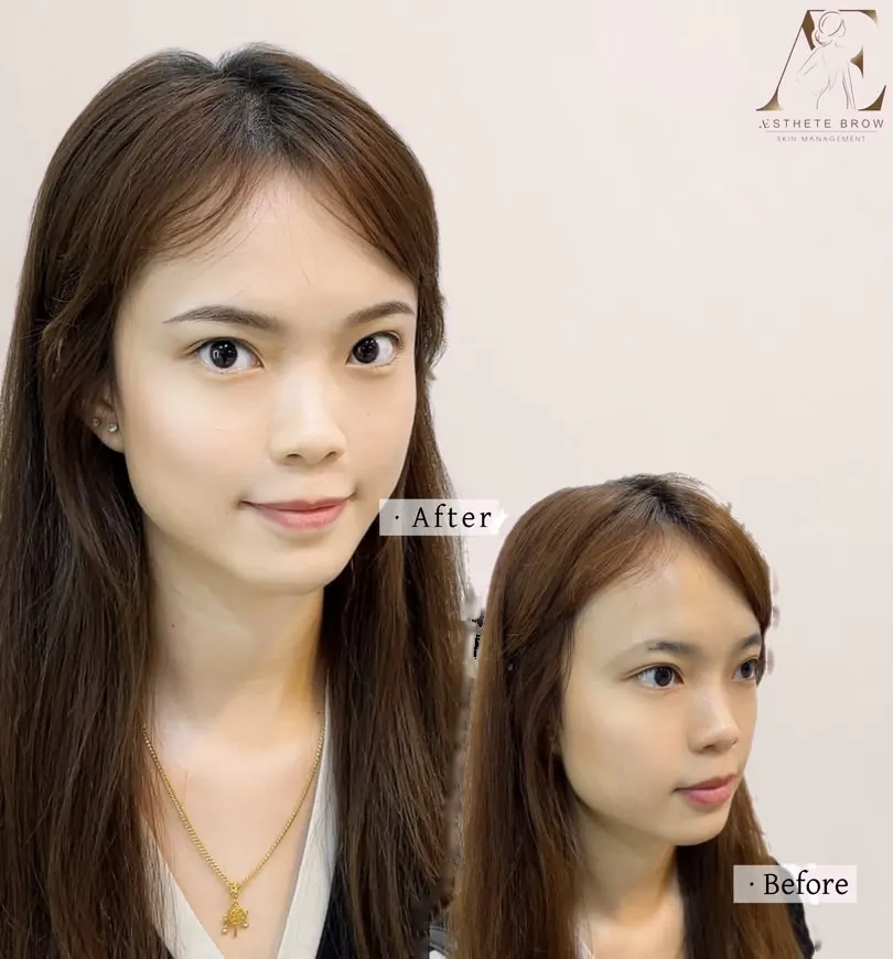 A client before and after eyebrow embroidery at Aesthete: fuller, softly shaped brows after